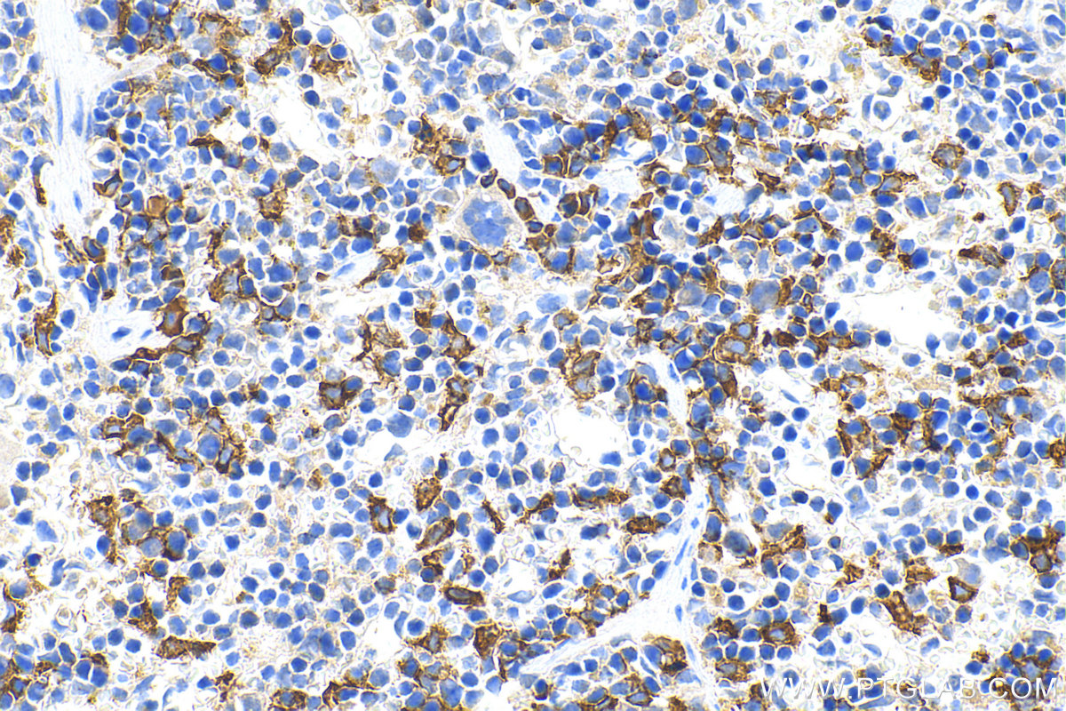 IHC staining of mouse spleen using 31024-1-AP