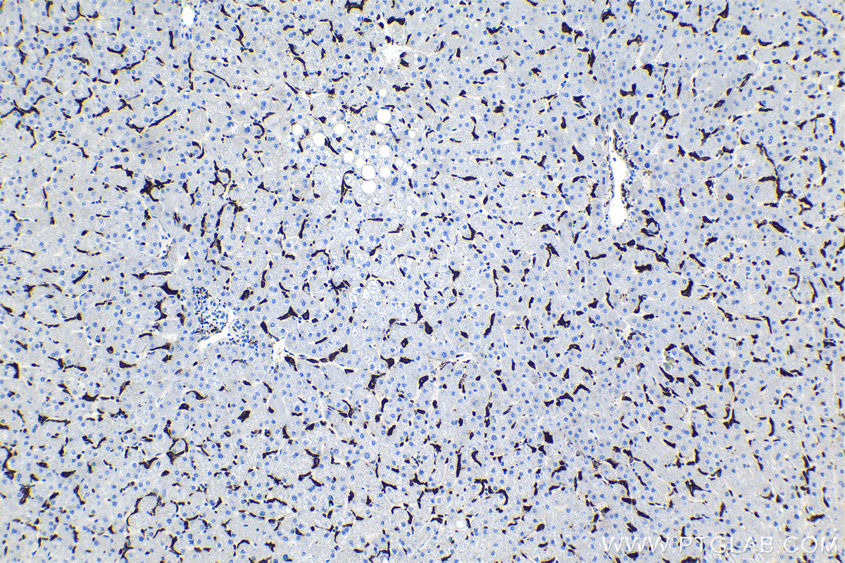 IHC staining of human liver using 68218-1-Ig