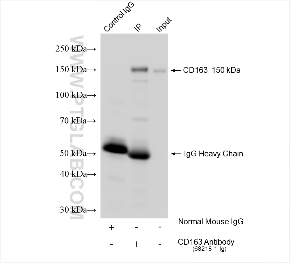 IP experiment of human placenta using 68218-1-Ig (same clone as 68218-1-PBS)