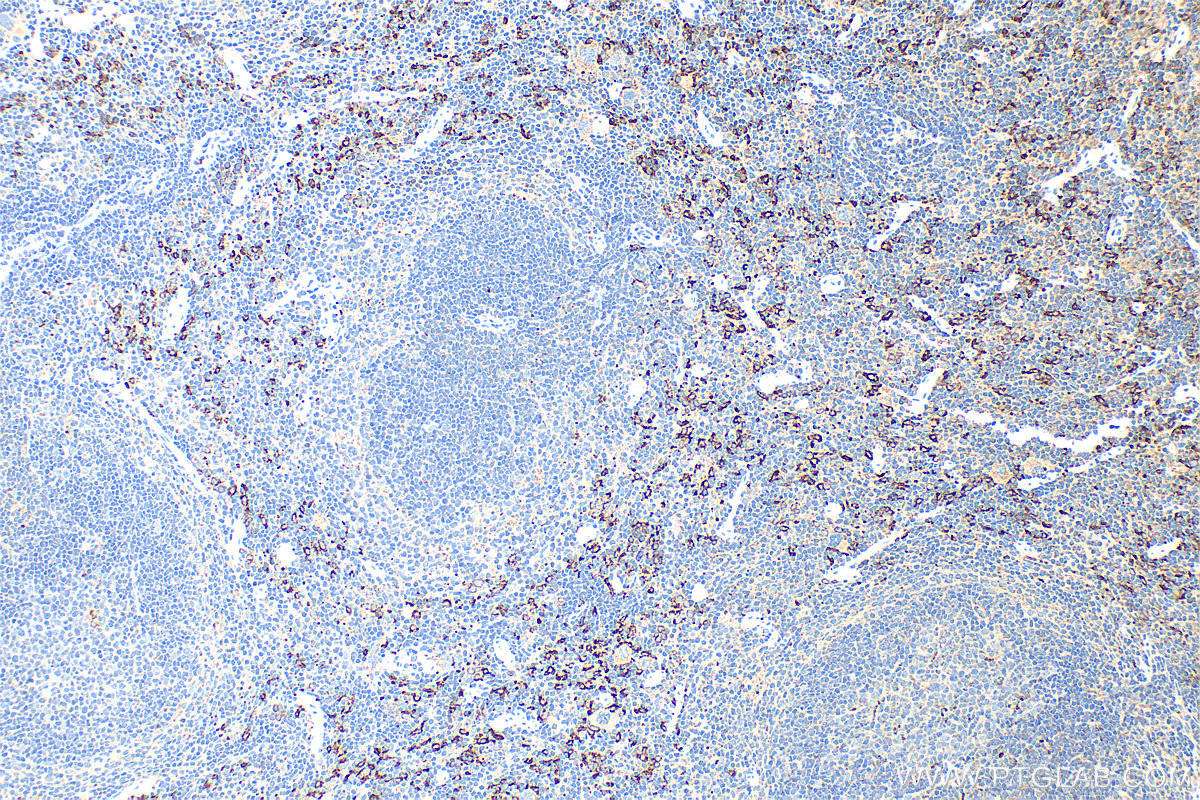 IHC staining of mouse spleen using 83285-4-RR