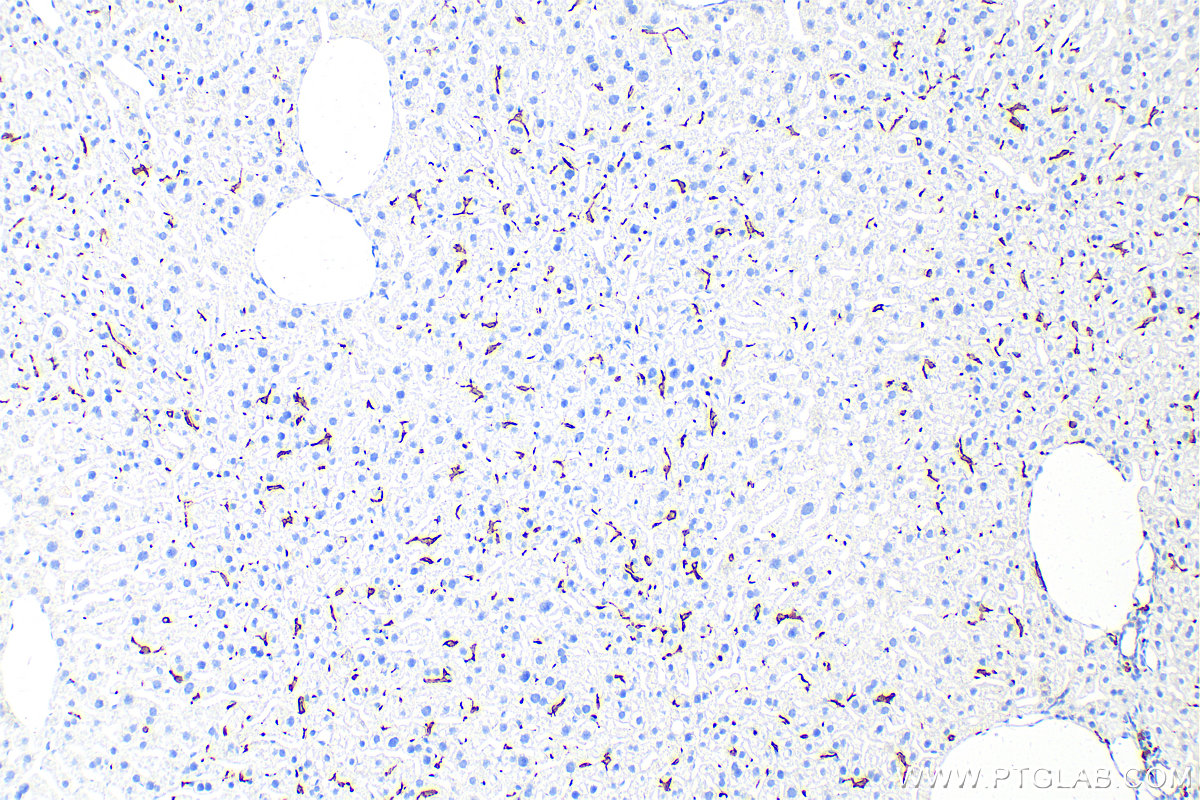 IHC staining of mouse liver using 83285-4-RR (same clone as 83285-4-PBS)