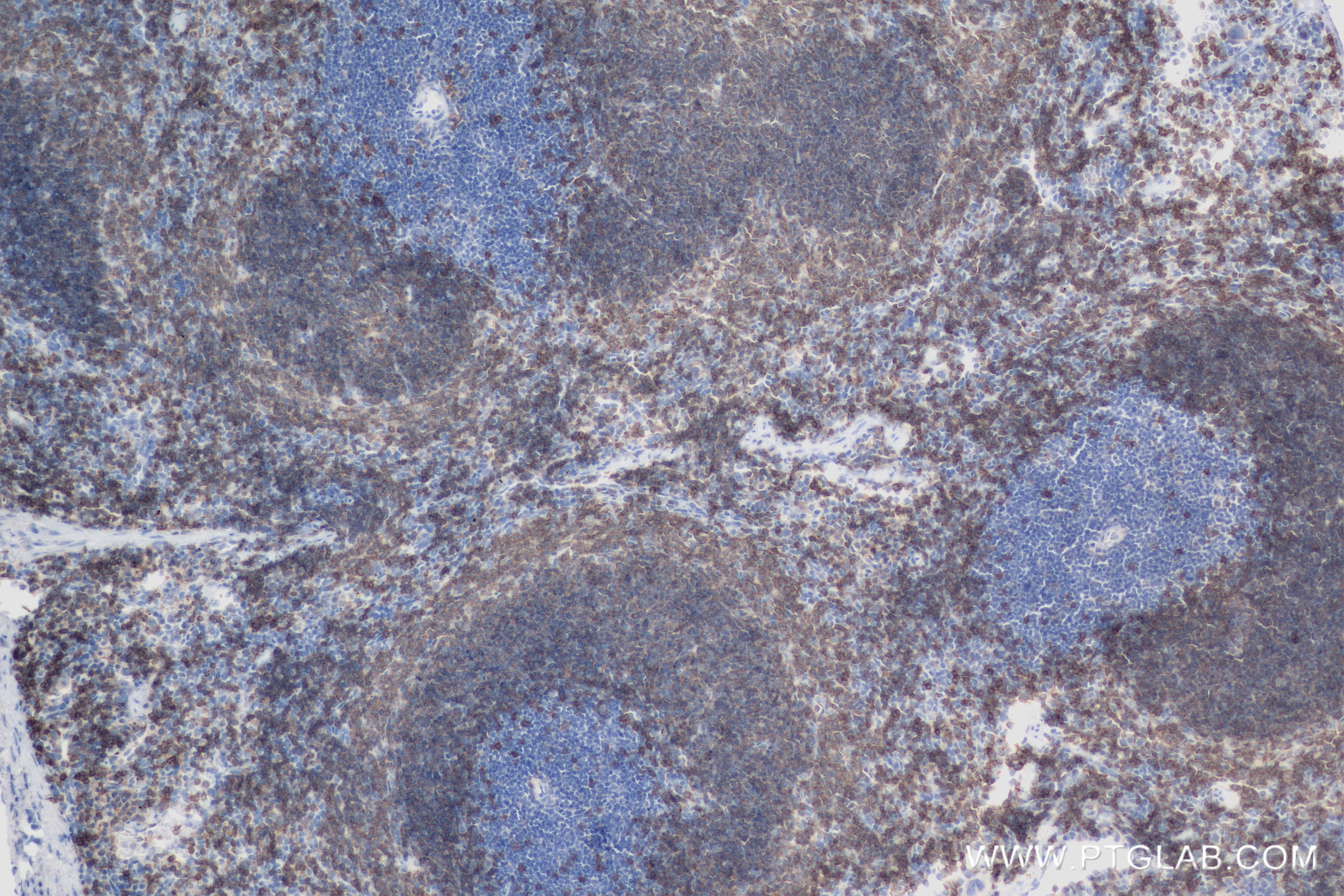 IHC staining of mouse spleen using 83254-1-RR