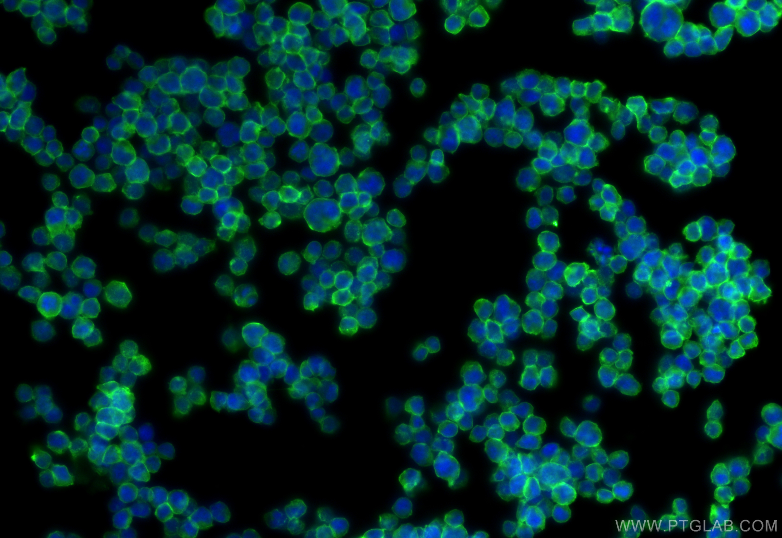 IF Staining of Jurkat using 31803-1-AP