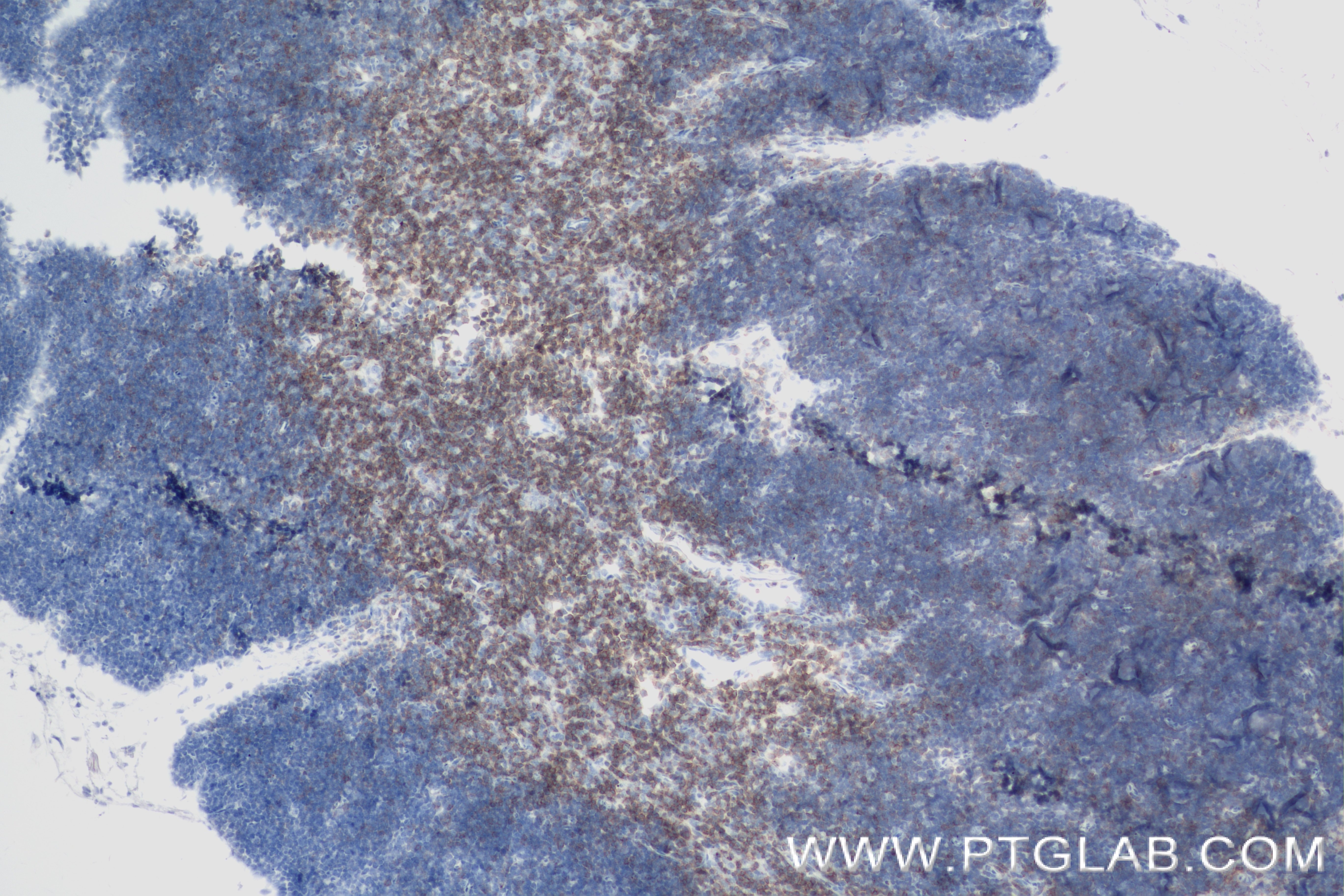 IHC staining of mouse thymus using 84360-4-RR (same clone as 84360-4-PBS)