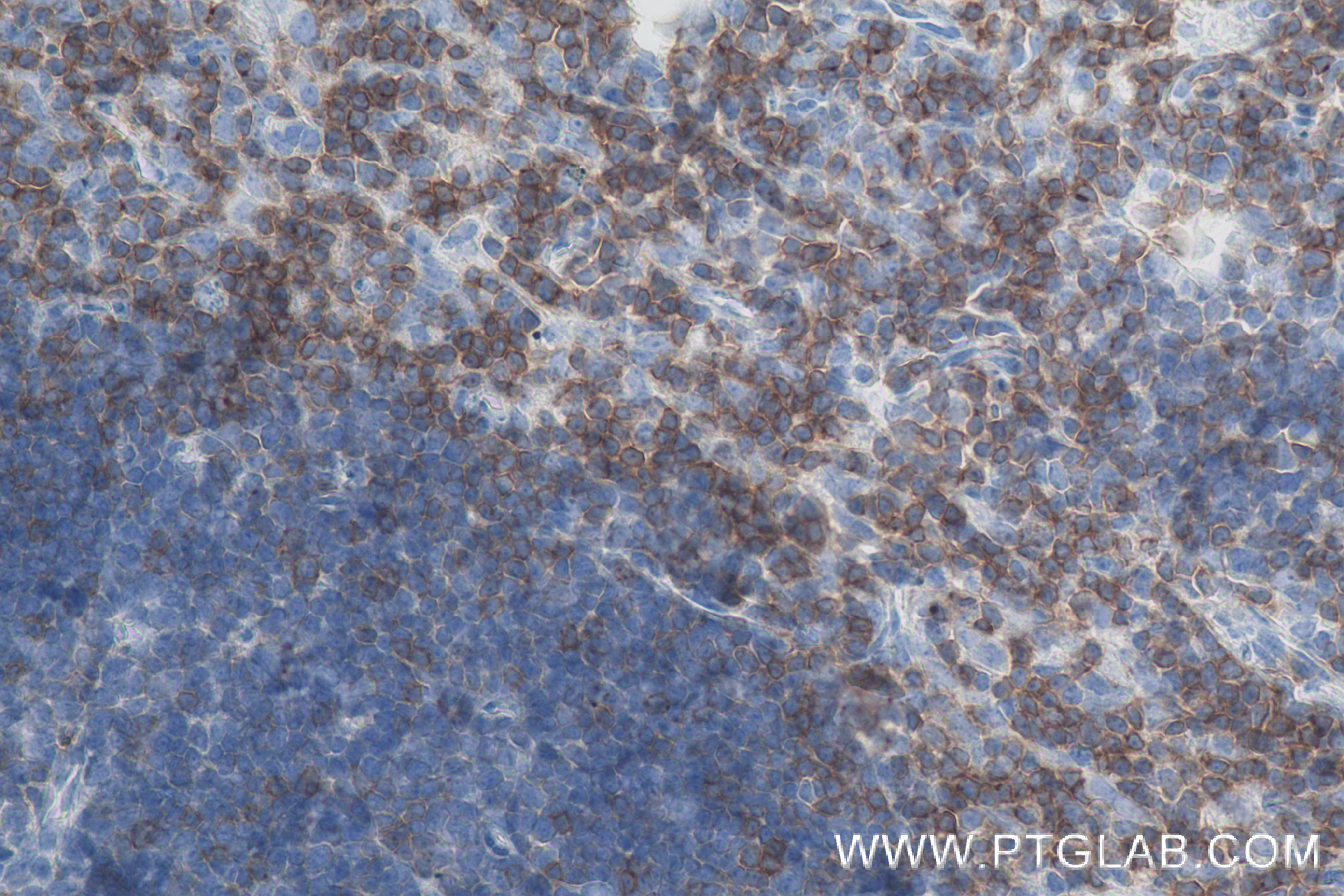 IHC staining of mouse thymus using 84360-4-RR (same clone as 84360-4-PBS)