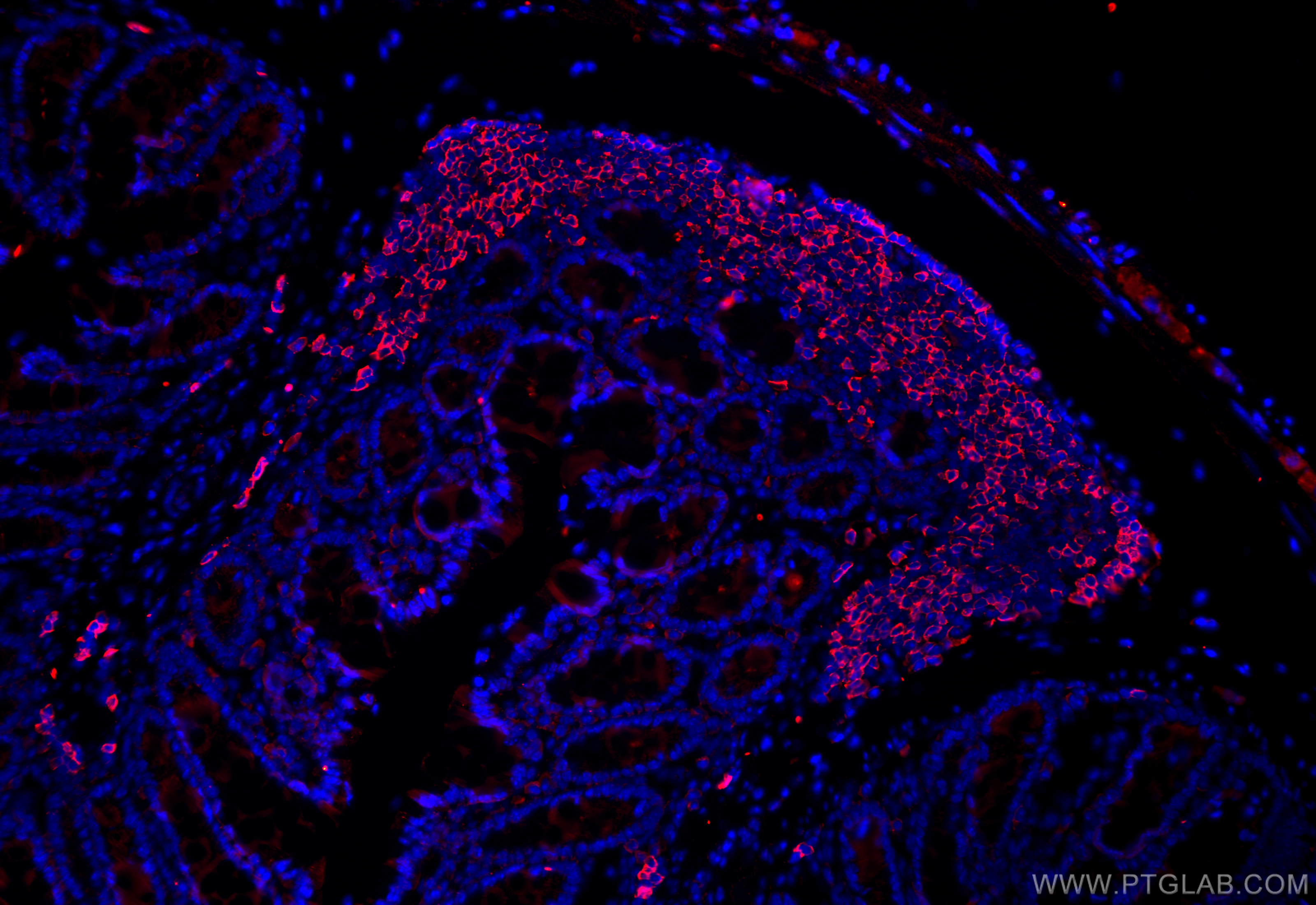 IF Staining of mouse colon using 31909-1-AP