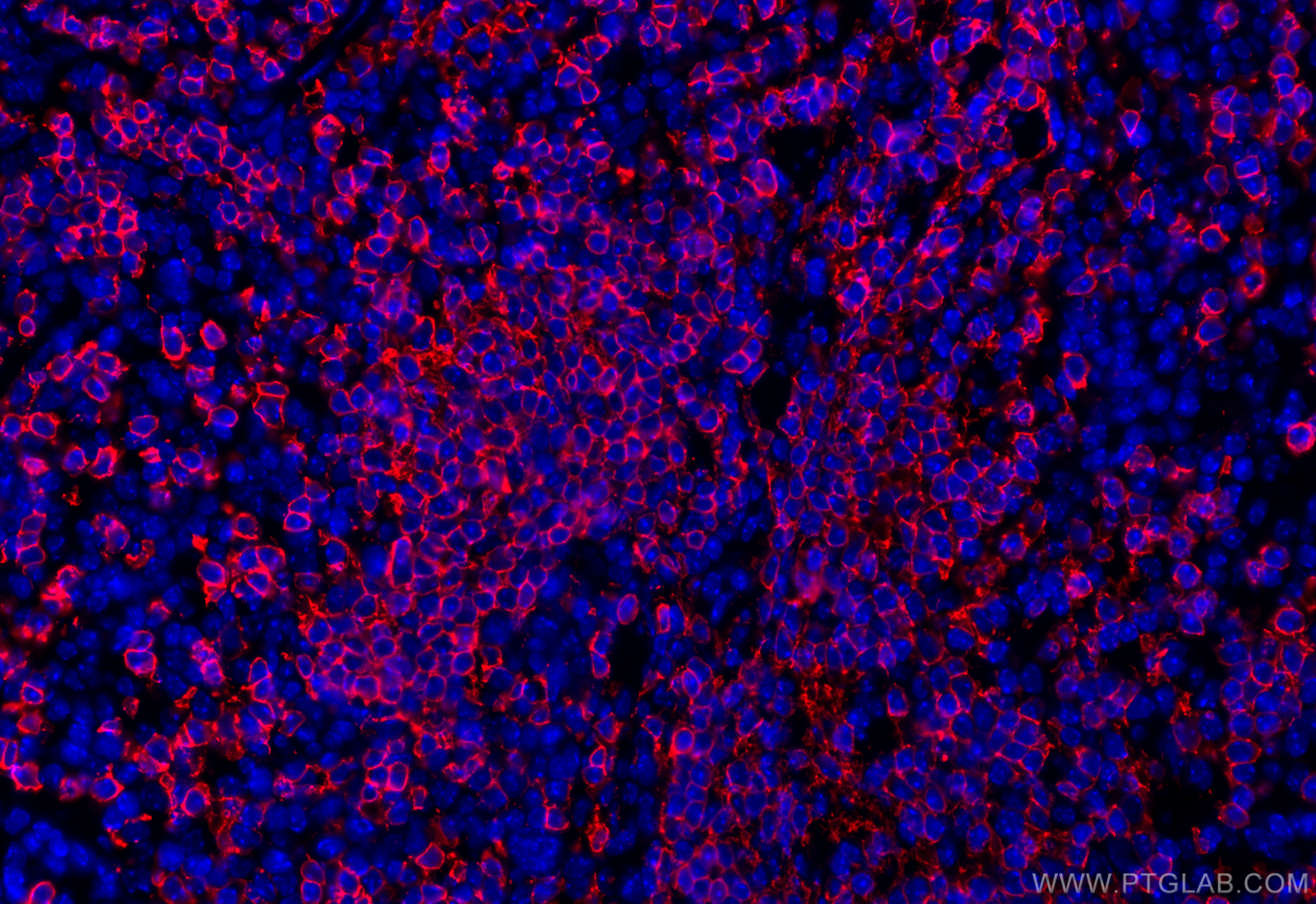 IF Staining of mouse spleen using 31909-1-AP