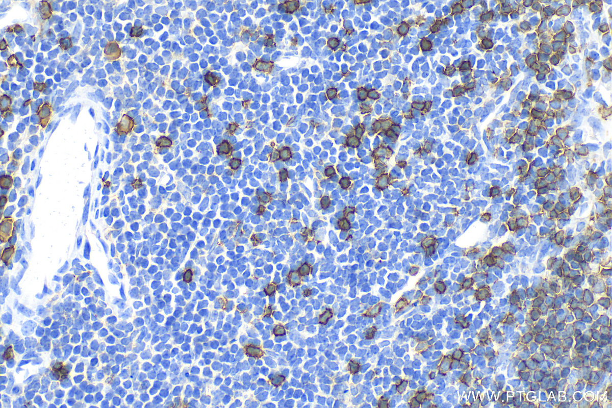 IHC staining of mouse spleen using 31909-1-AP