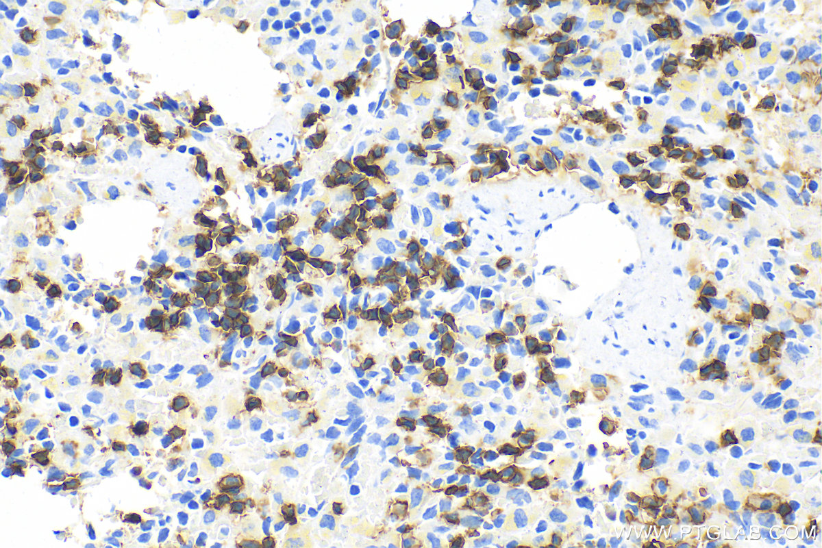 IHC staining of rat spleen using 31909-1-AP