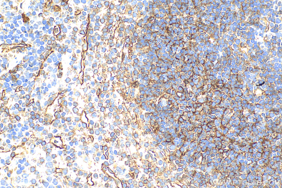 IHC staining of mouse spleen using 31444-1-AP