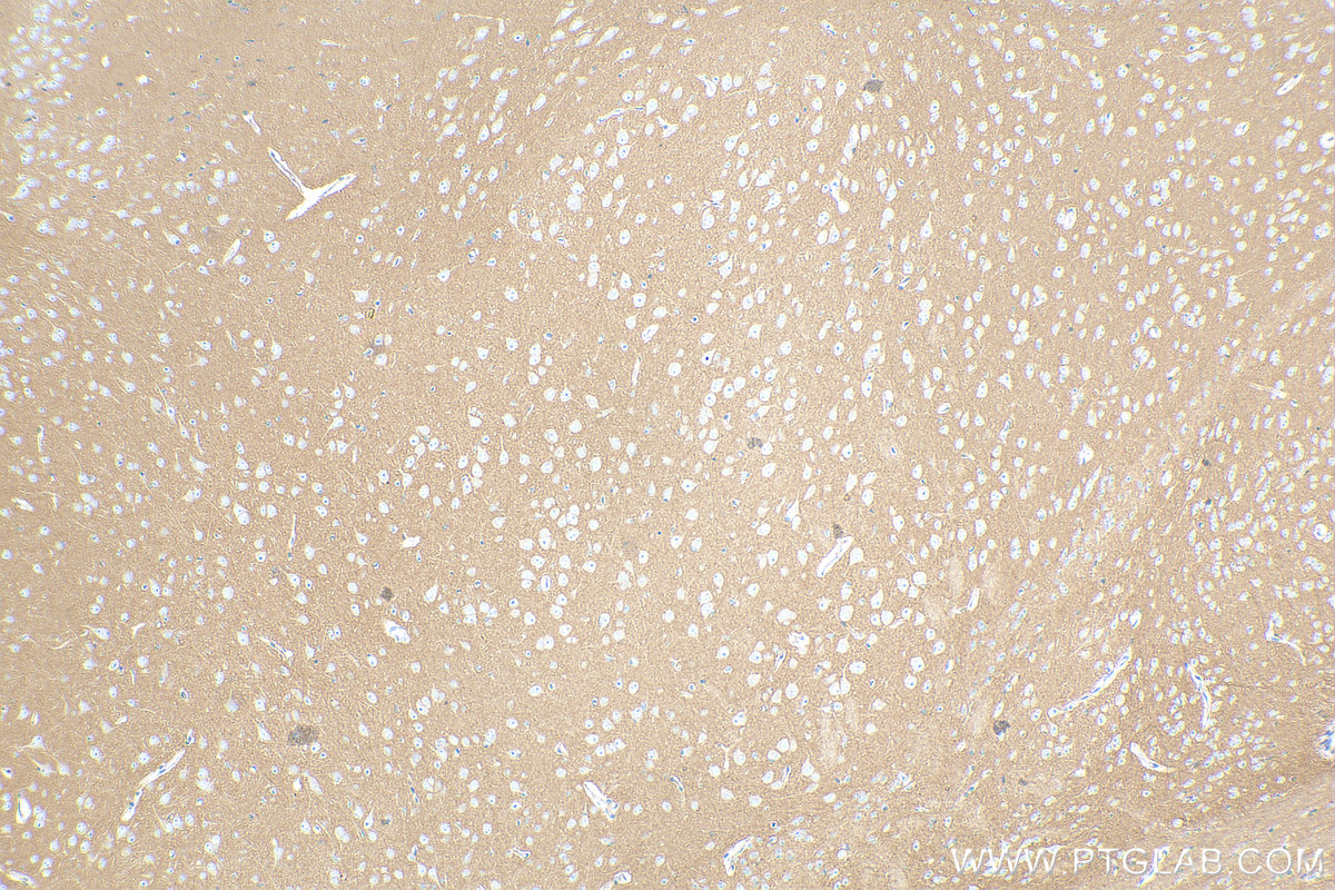 IHC staining of mouse brain using 83437-5-RR (same clone as 83437-5-PBS)