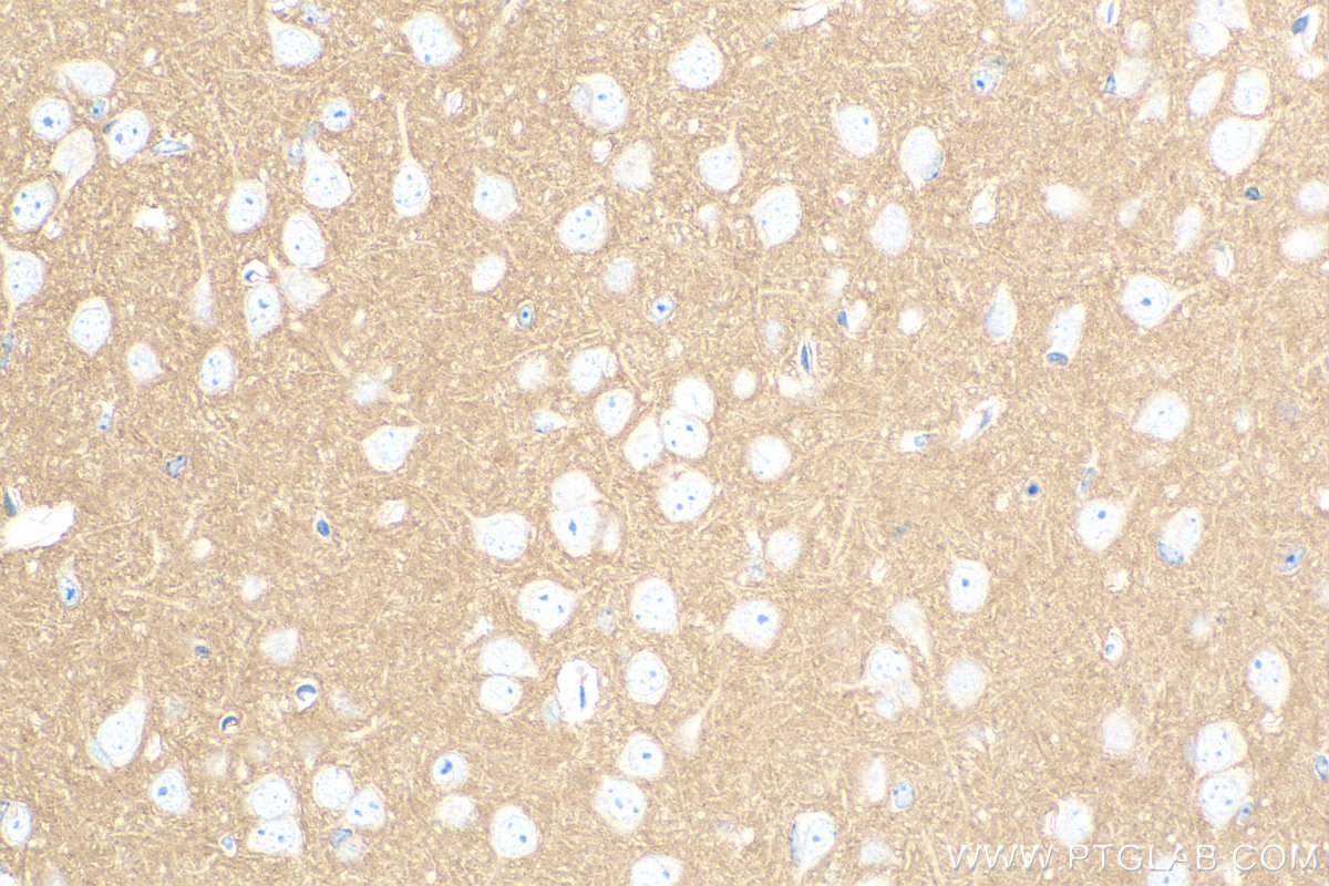 IHC staining of mouse brain using 83437-5-RR (same clone as 83437-5-PBS)