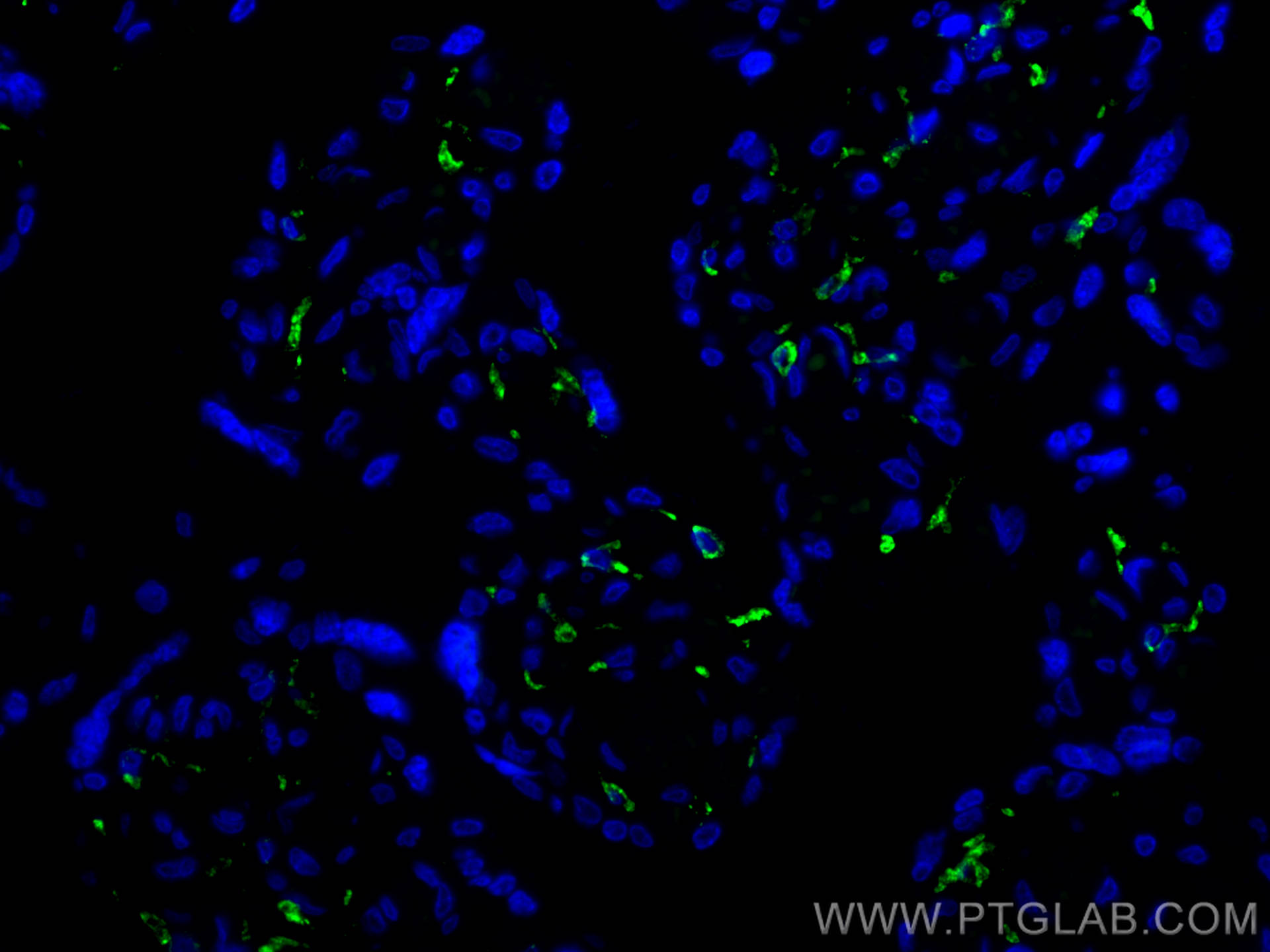 IF Staining of human placenta using CL488-81525