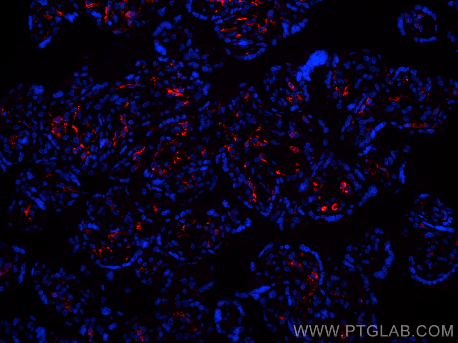 IF Staining of human placenta using CL594-81525