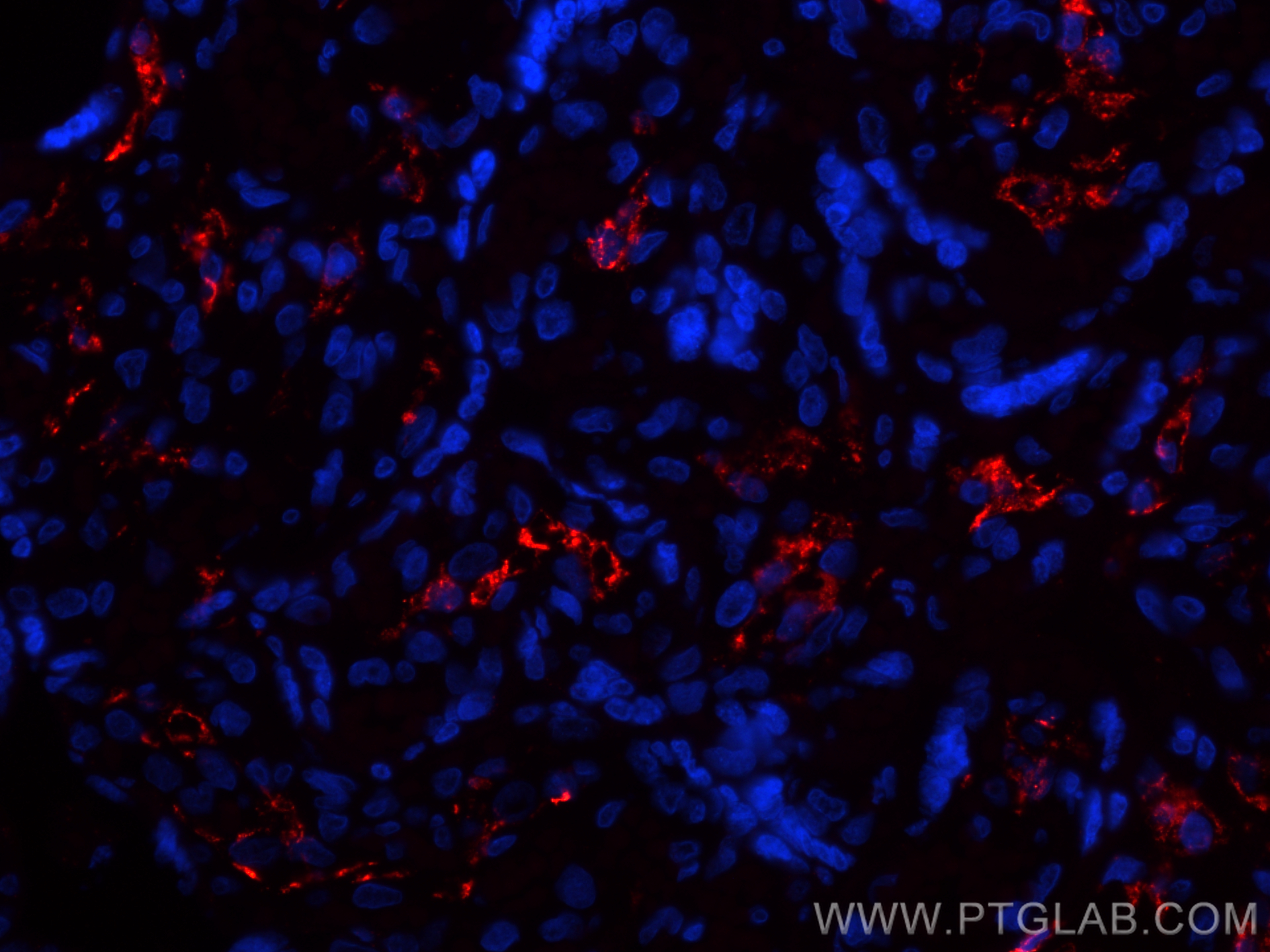 IF Staining of human placenta using CL594-81525