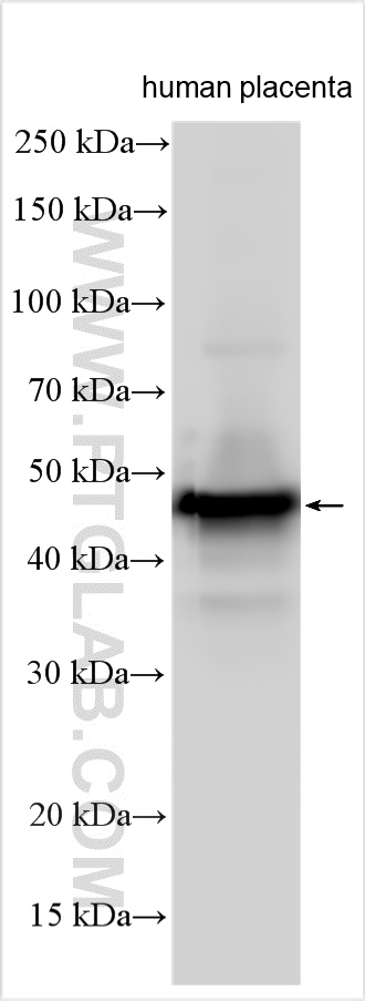 WB analysis using 31621-1-AP