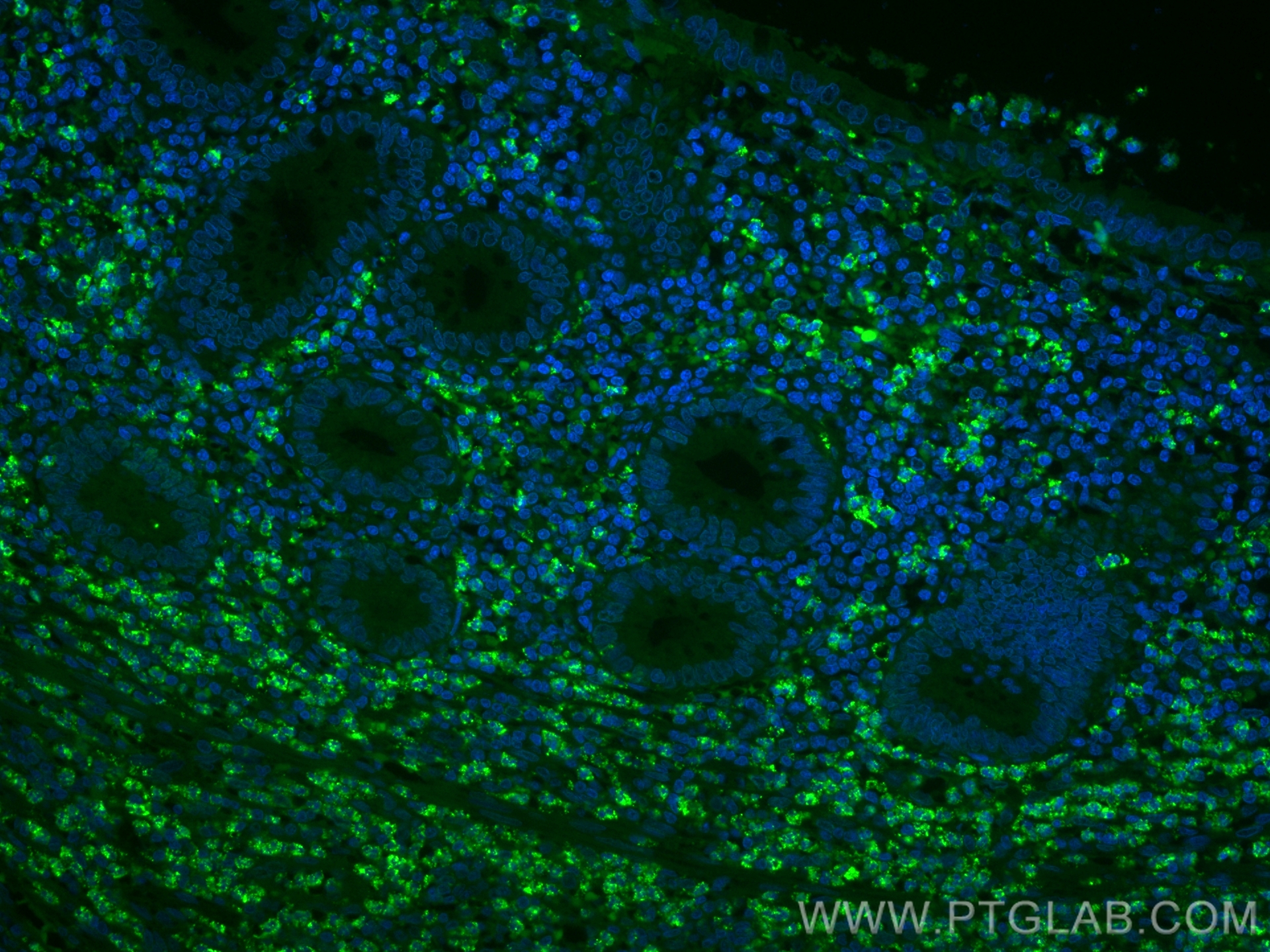 IF Staining of human appendicitis using CL488-66103