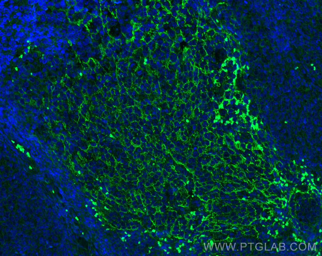 IF Staining of human tonsillitis using 60208-1-Ig (same clone as 60208-1-PBS)