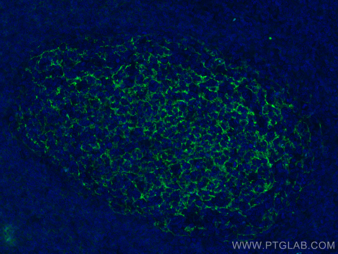 IF Staining of human tonsillitis using 60208-2-Ig