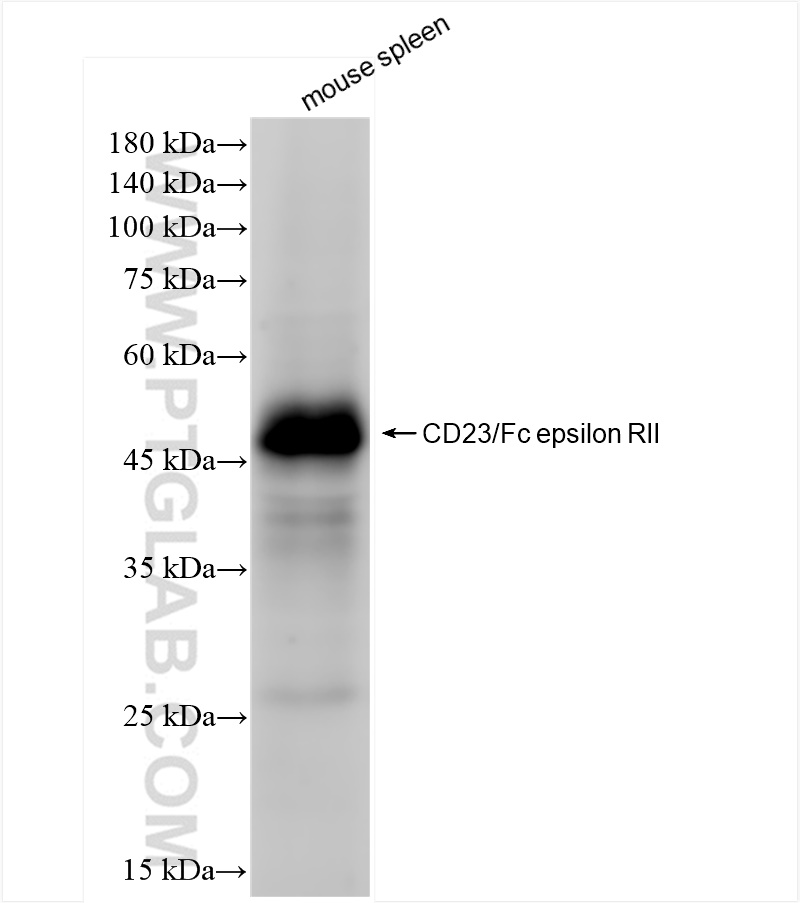 WB analysis of mouse spleen using 84212-3-RR (same clone as 84212-3-PBS)