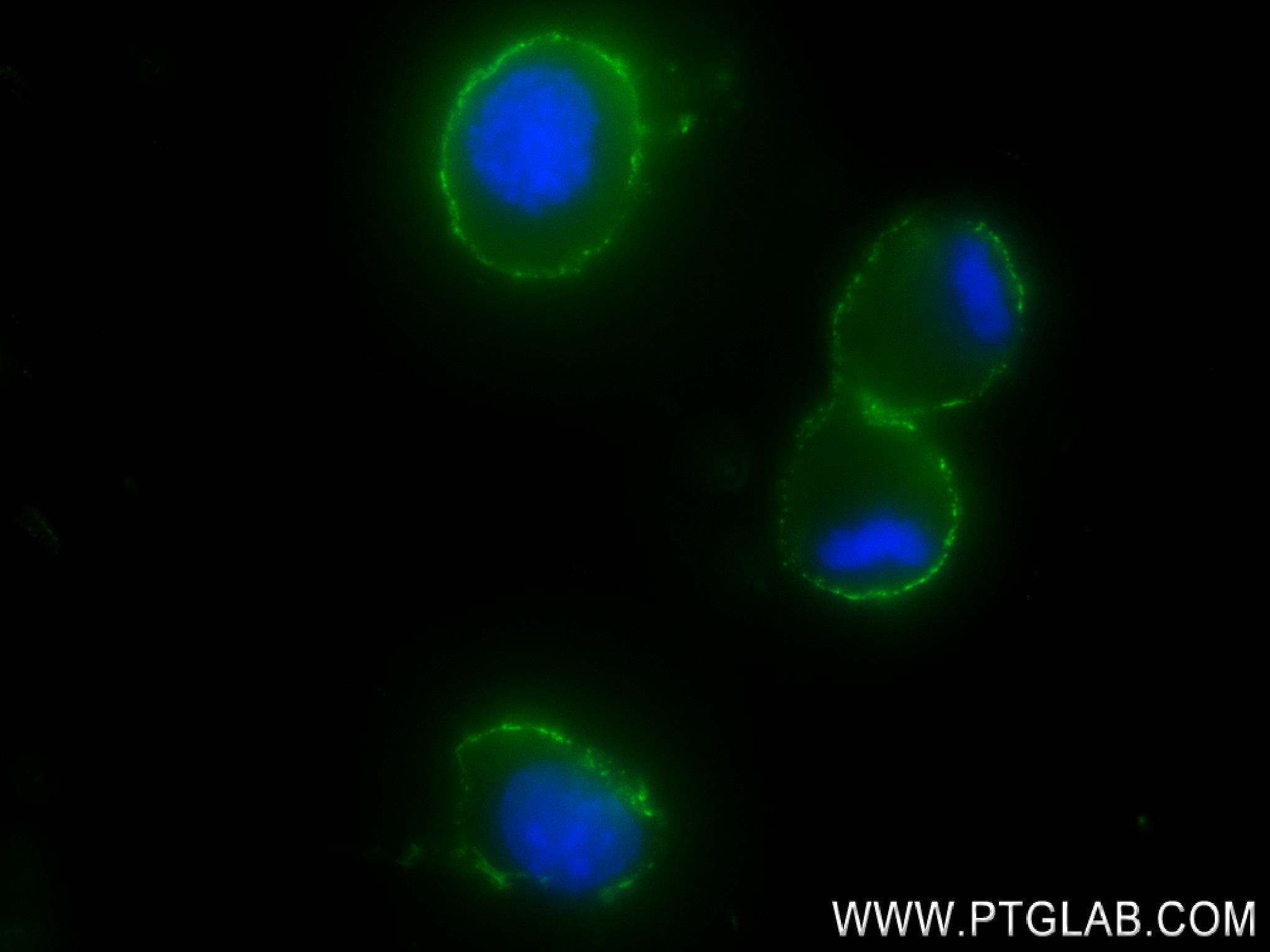 IF Staining of Neuro-2a using 84342-5-RR