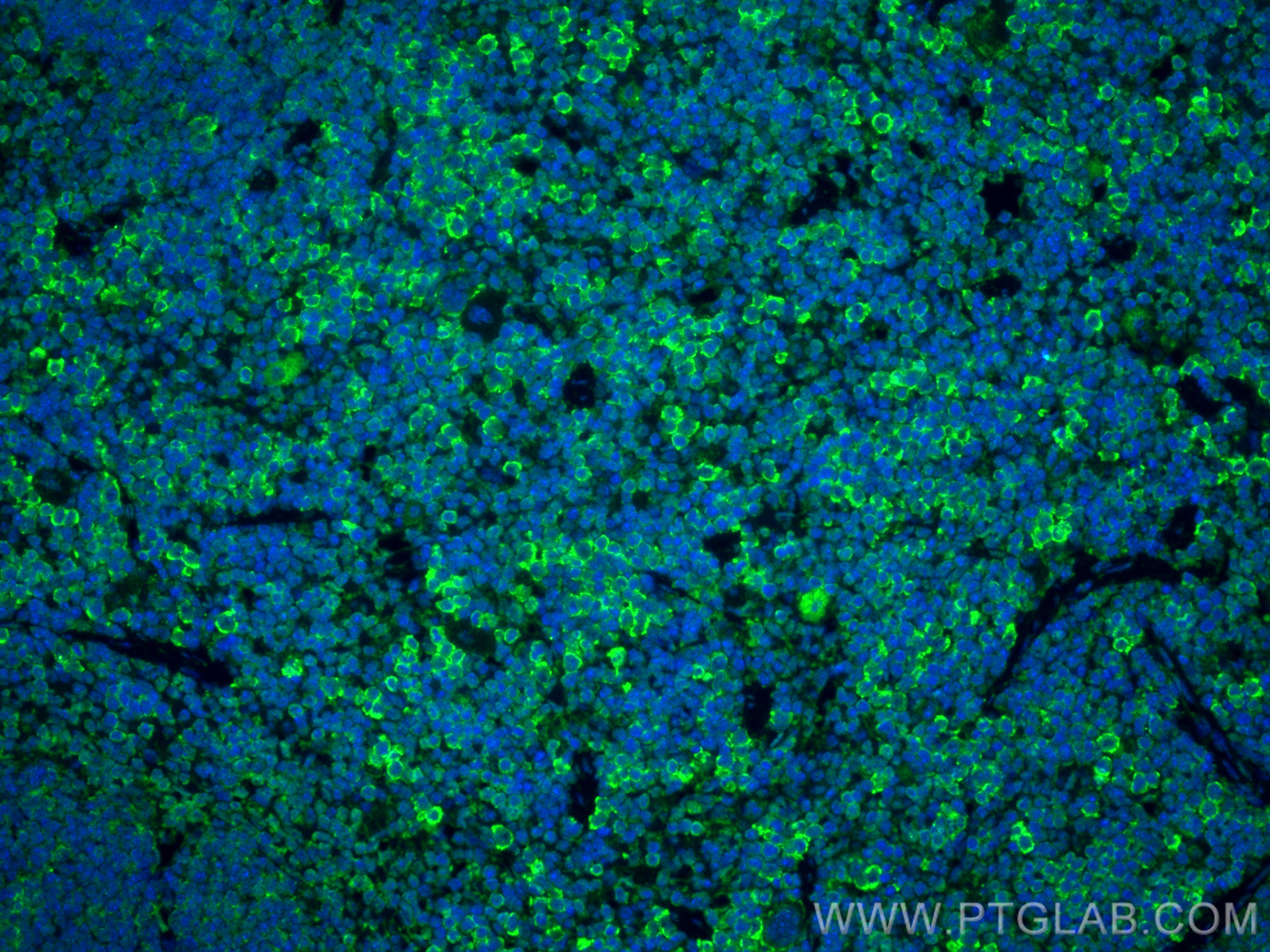 IF Staining of mouse spleen using 81324-1-RR