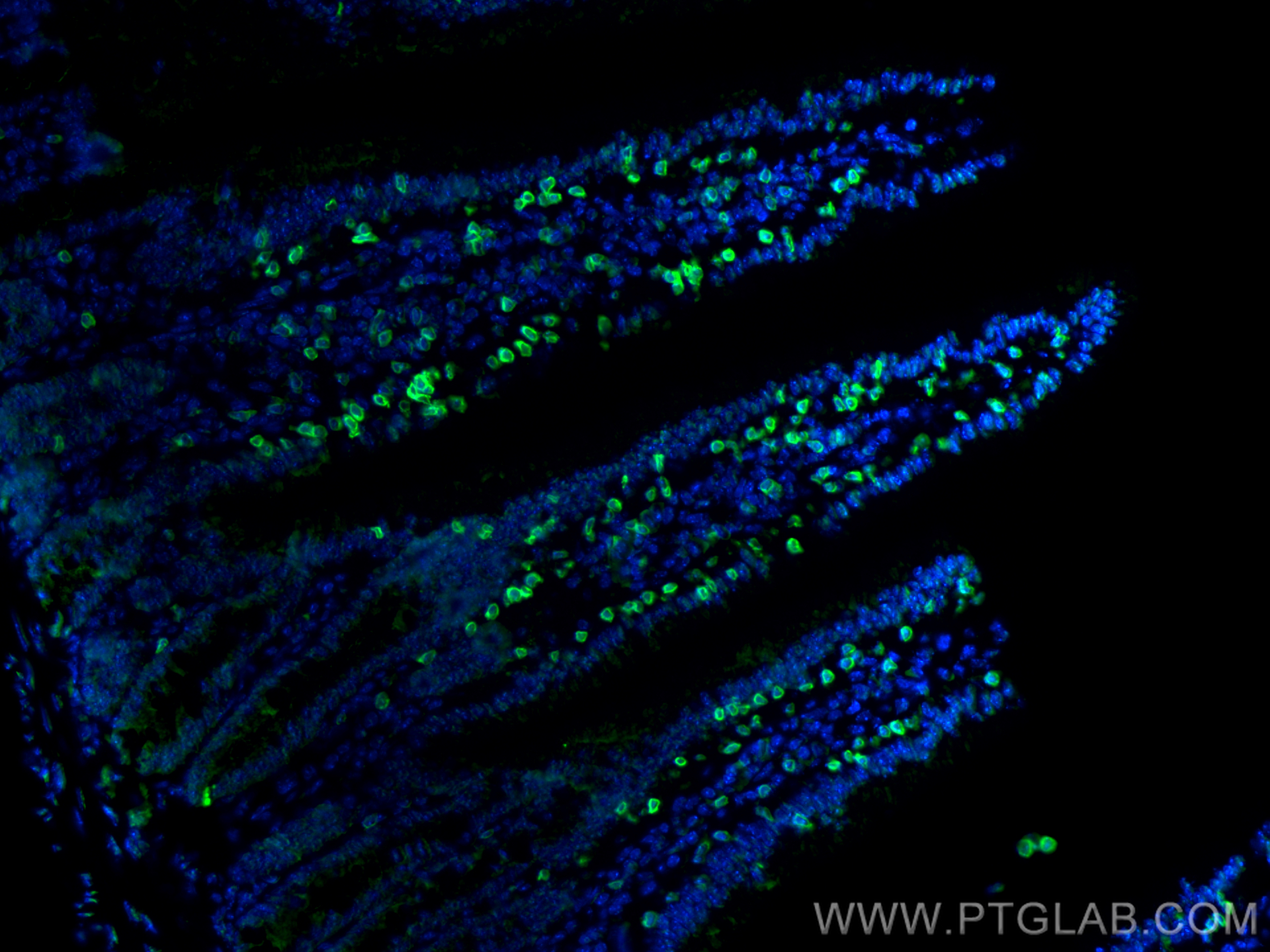 IF Staining of mouse small intestine using 81324-1-RR