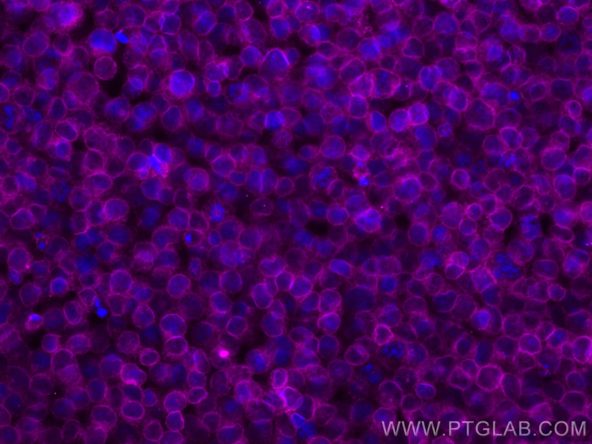 IF Staining of Jurkat using CL647-60181