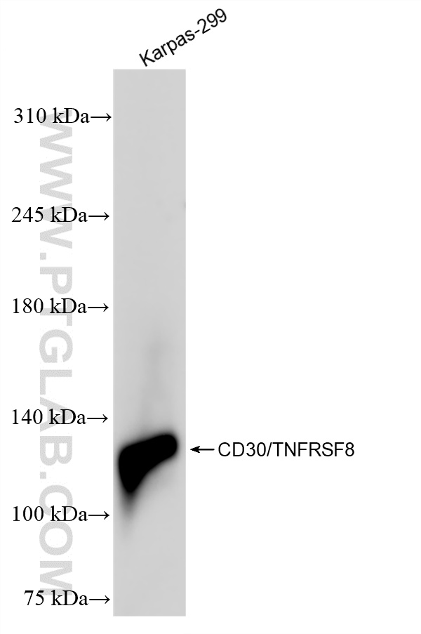 WB analysis of Karpas-299 using 84241-2-RR (same clone as 84241-2-PBS)