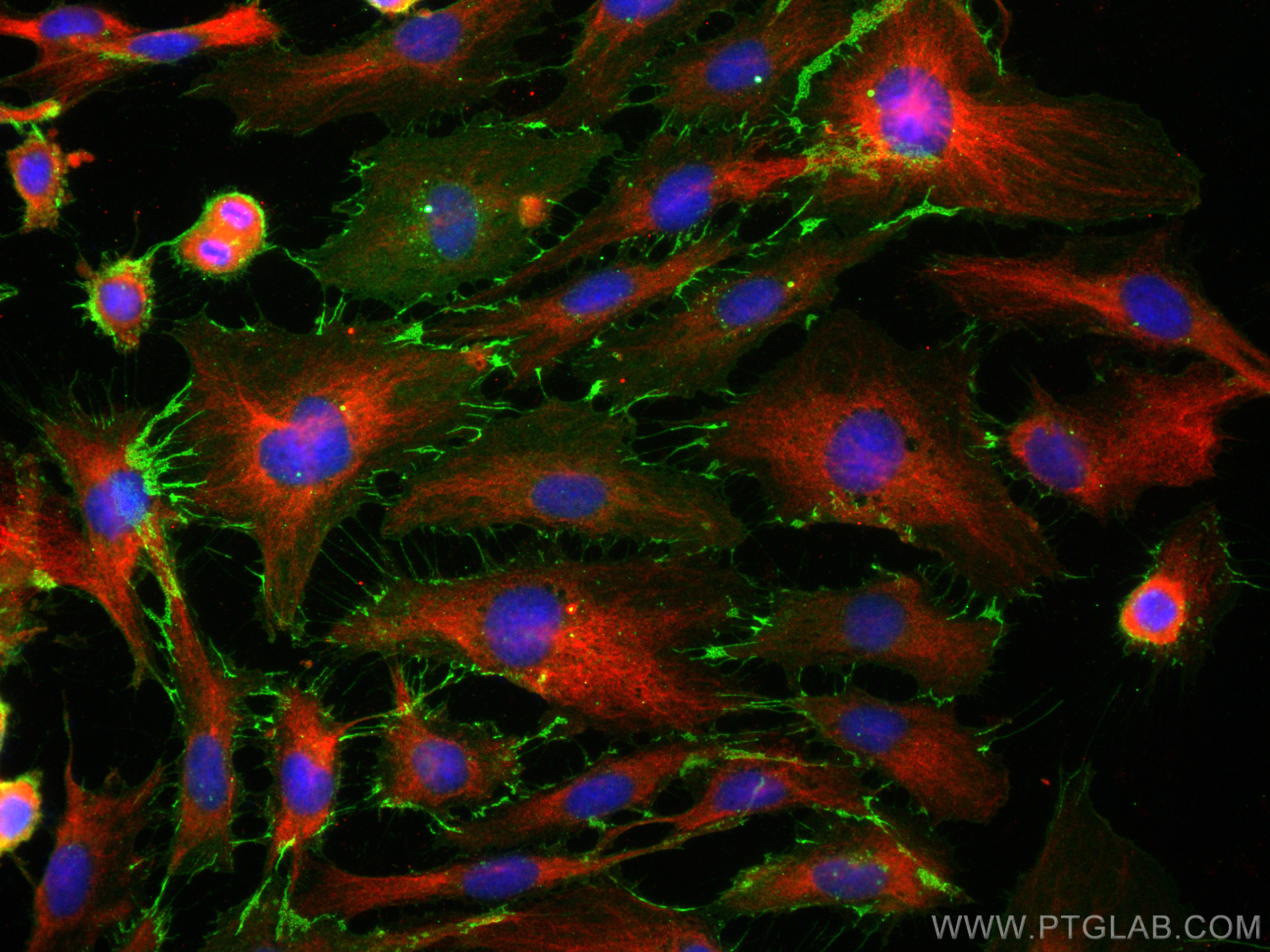 IF Staining of HUVEC using 66065-2-Ig