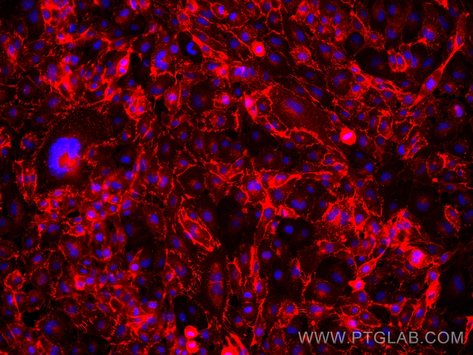 IF Staining of HUVEC using 66065-2-Ig (same clone as 66065-2-PBS)