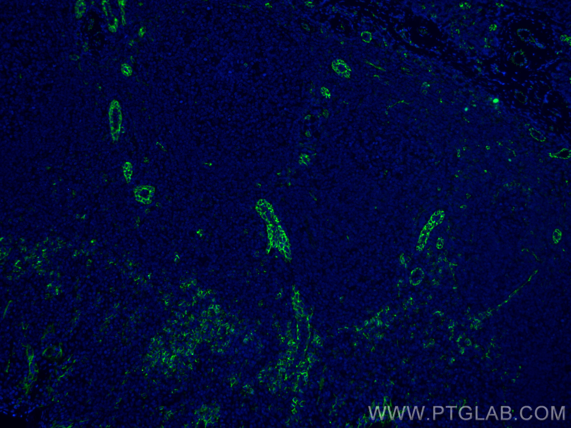 IF Staining of human tonsillitis using CL488-66065