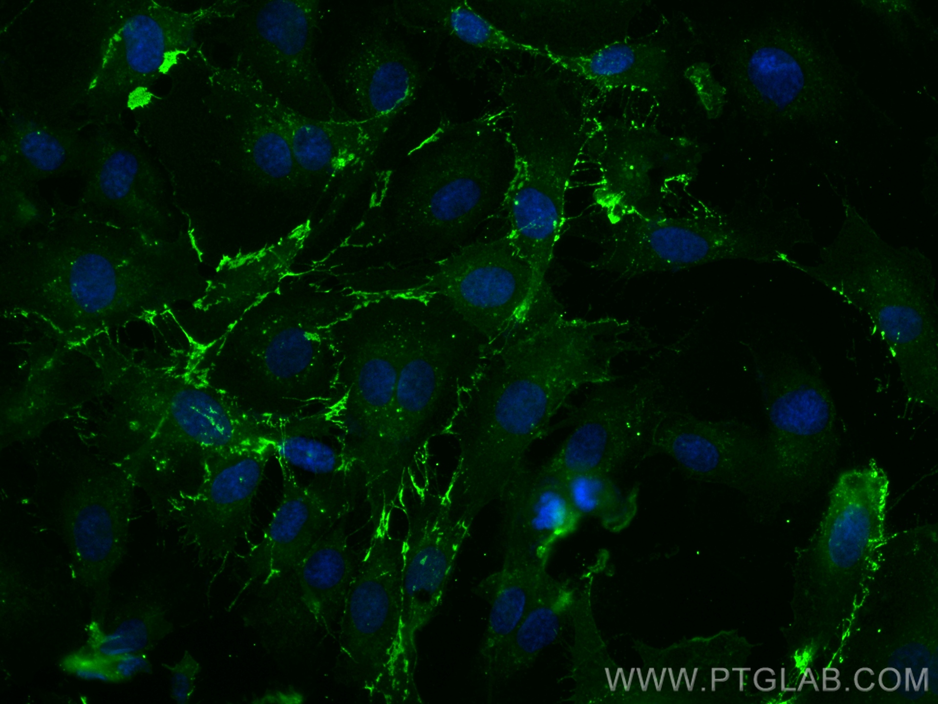 IF Staining of HUVEC using CL488-80530