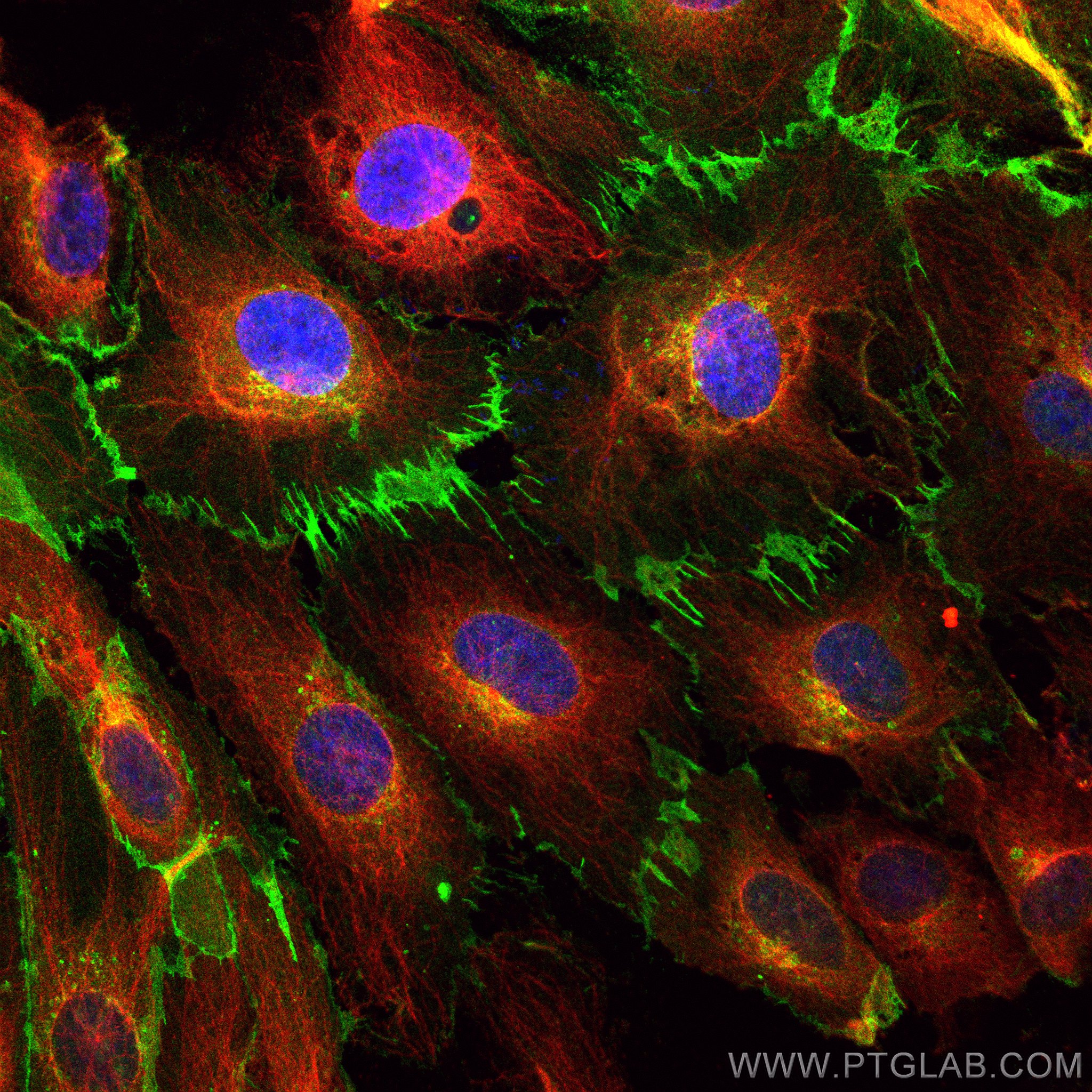 IF Staining of HUVEC using CL488-80530