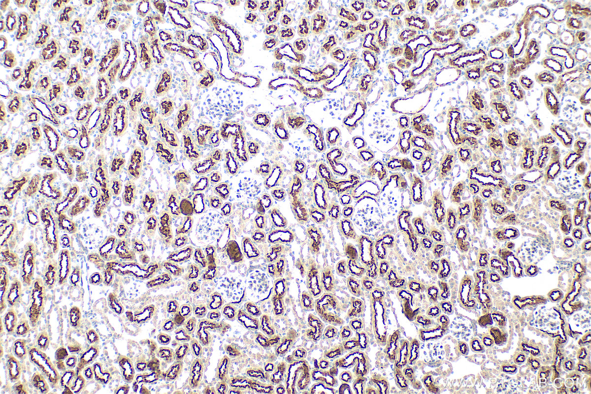 IHC staining of mouse kidney using 10343-1-AP