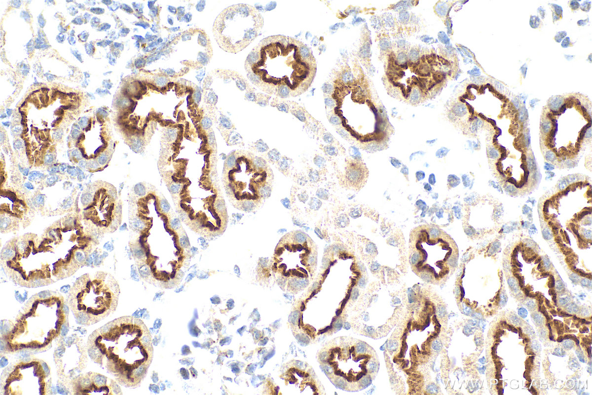 IHC staining of mouse kidney using 10343-1-AP