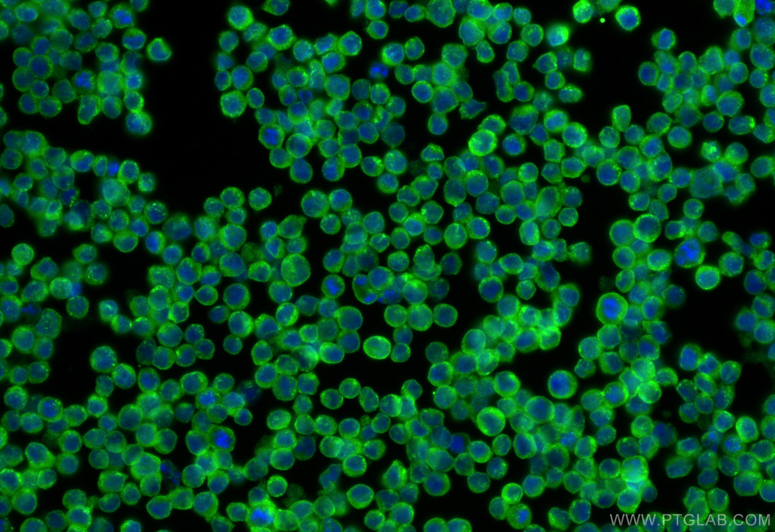 IF Staining of Raji using 24145-1-AP