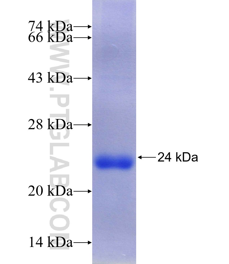 CD320 fusion protein Ag30105 SDS-PAGE