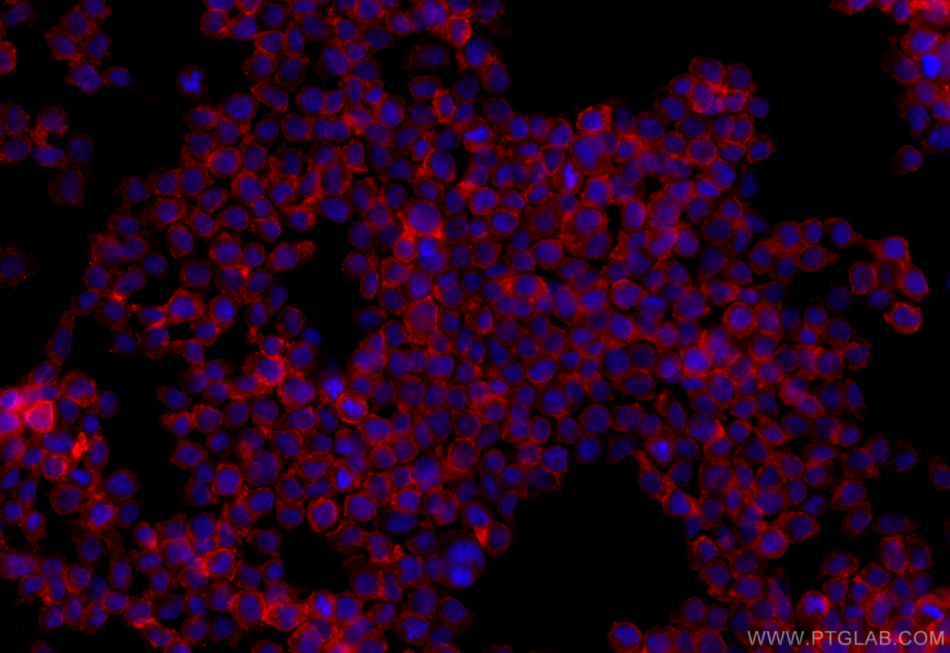 IF Staining of THP-1 using 17425-1-AP