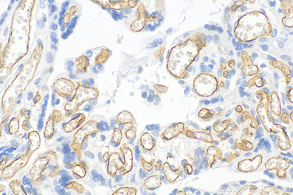 IHC staining of human placenta using 14486-1-AP