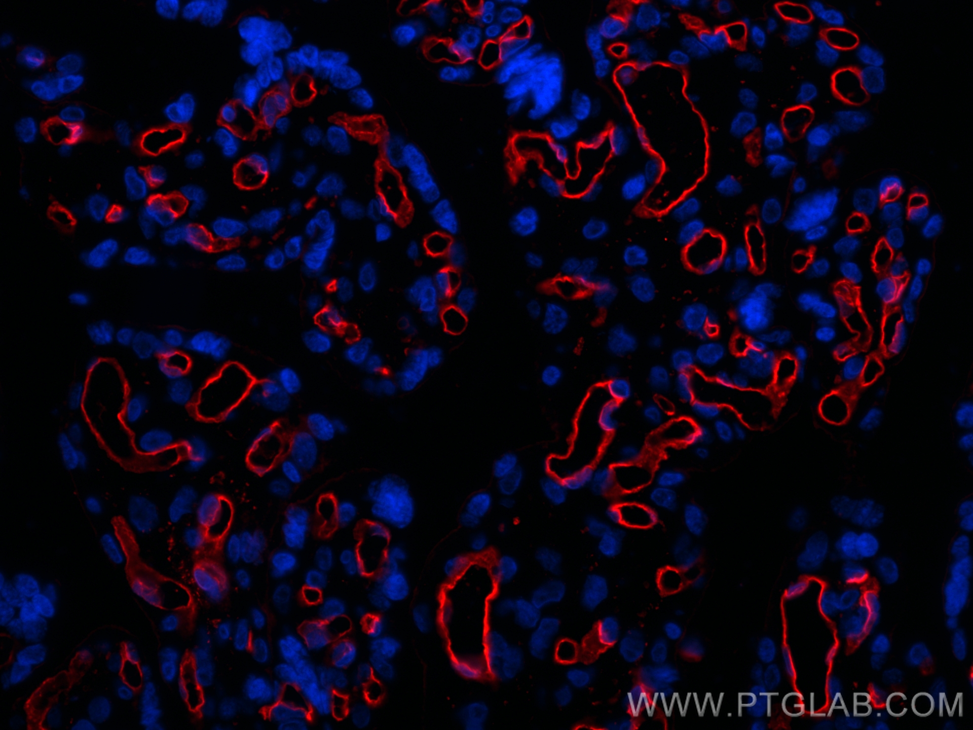 IF Staining of human placenta using 32211-1-AP