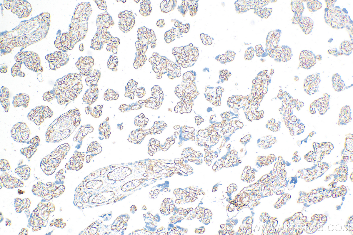 IHC staining of human placenta using 32211-1-AP