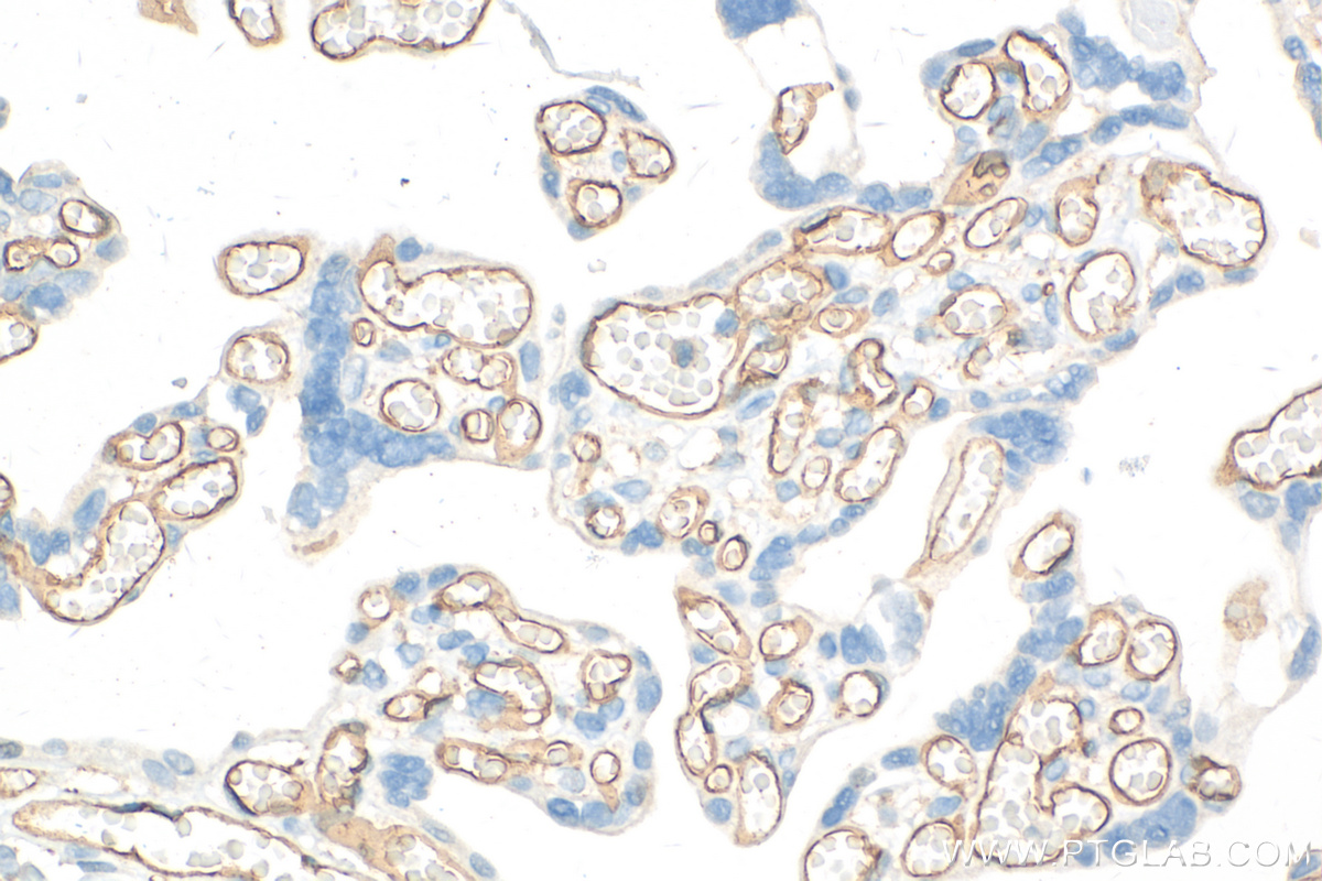 IHC staining of human placenta using 32211-1-AP