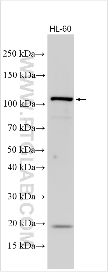 WB analysis using 32211-1-AP