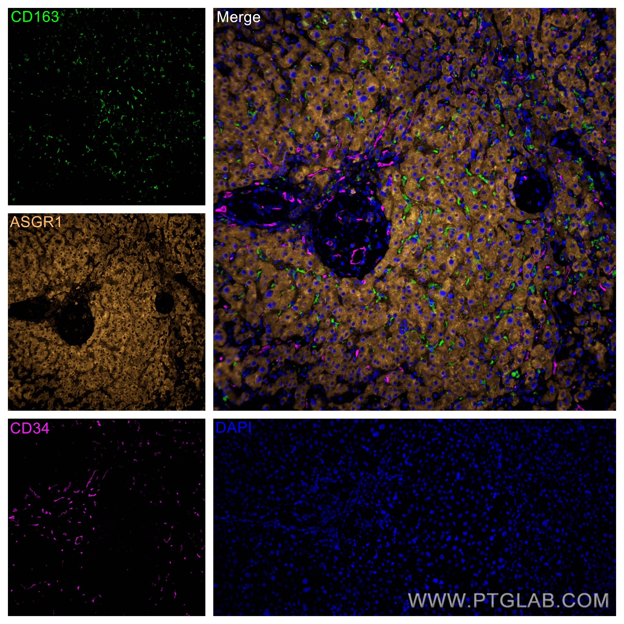 IF Staining of human liver using 60180-1-Ig