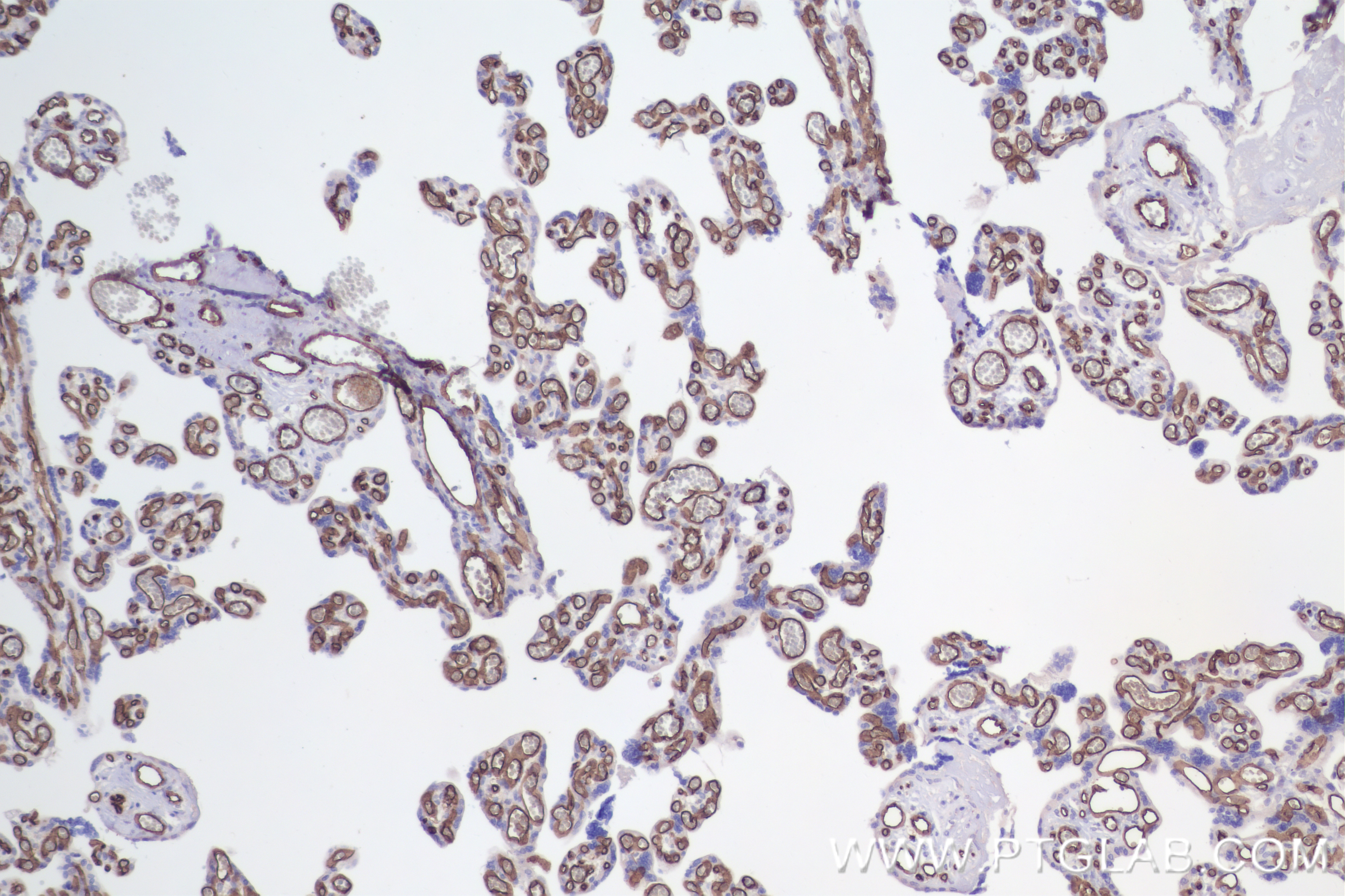 IHC staining of human placenta using 84242-5-RR