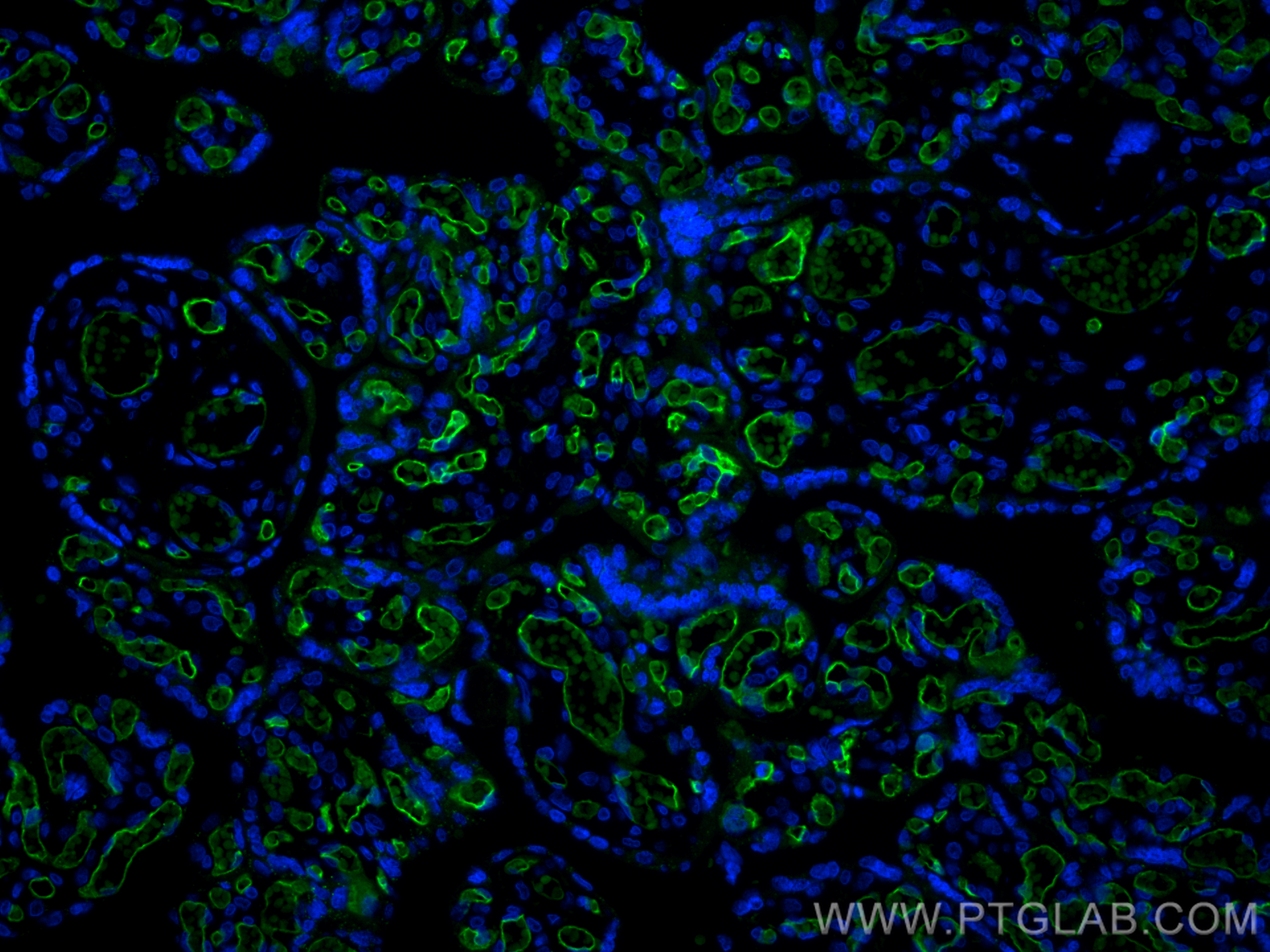 IF Staining of human placenta using CL488-60180