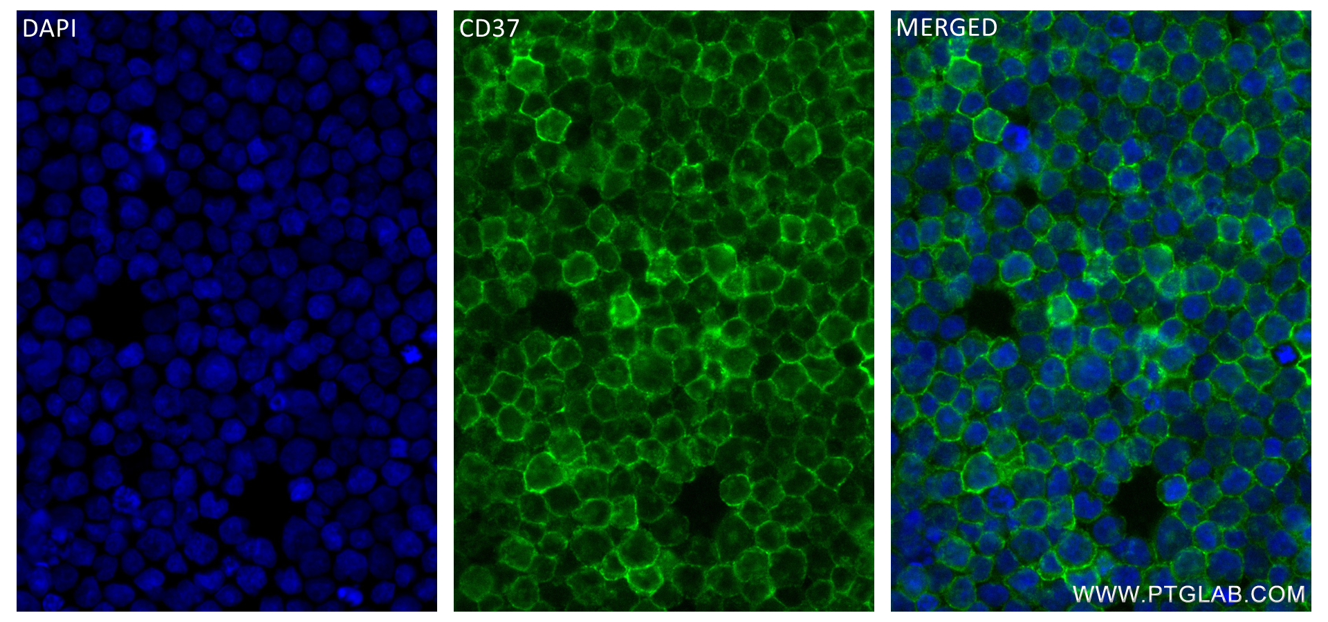 IF Staining of Daudi using 84509-2-RR