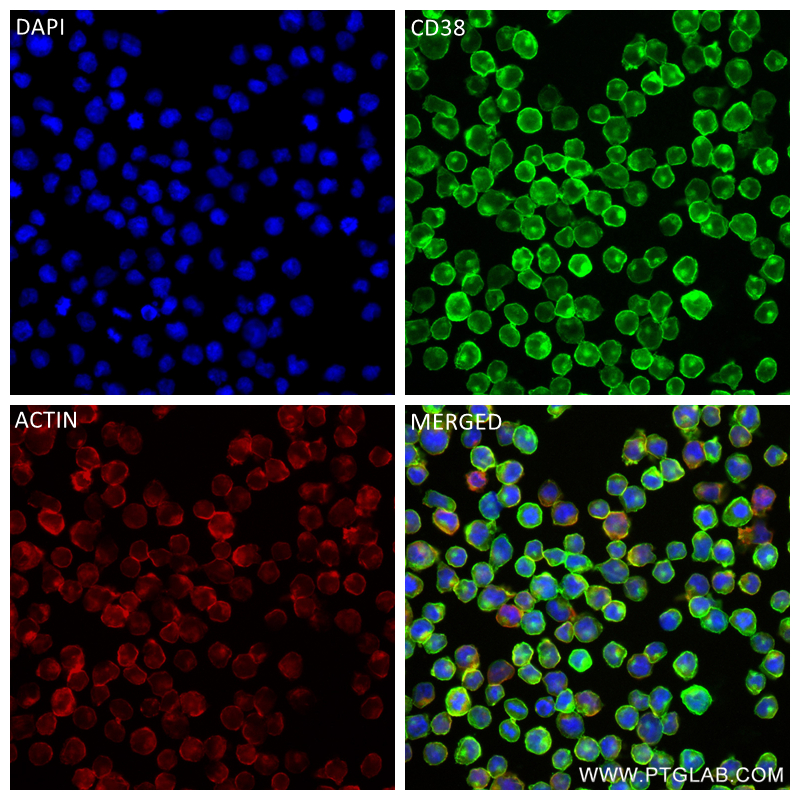 IF Staining of Raji using 84070-1-RR (same clone as 84070-1-PBS)