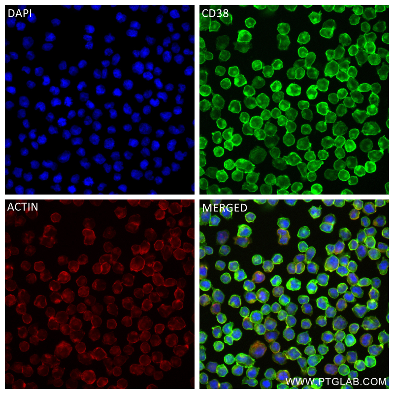 IF Staining of Raji using 84070-2-RR (same clone as 84070-2-PBS)